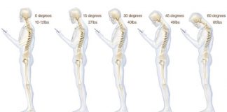 Má postura no uso de telemóvel pode causar dores de cabeça