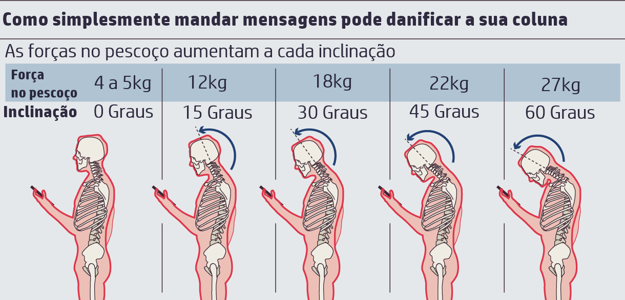 texting-neck-credit-thetimes-dot-co-dot-uk