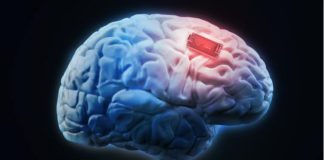 Elon Musk quer implantar dispositivos em cérebros humanos