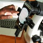 Uganda usa aplicativo para detectar malária em laboratório – Menos Fios