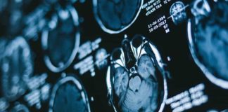 OMS conclui: Uso de telemóveis não está ligado ao câncer no cérebro